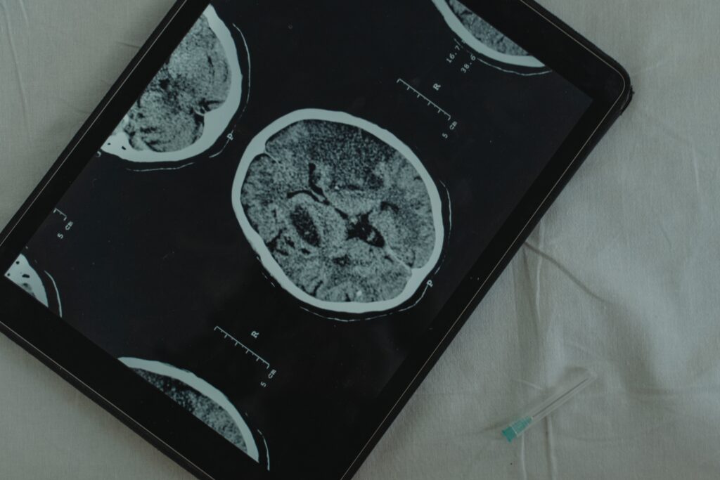 gut-brain health in addiction recovery